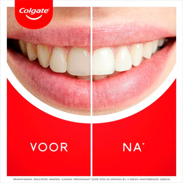 Colgate Max White Ultra Freshness Pearls Whitening Tandpasta