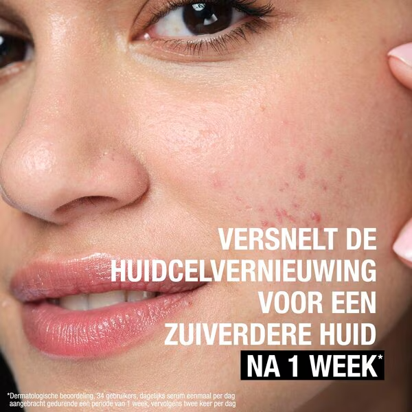 Neutrogena Anti-Puistjes+ 7% AHA + Panthenol Vloeibare Exfoliant